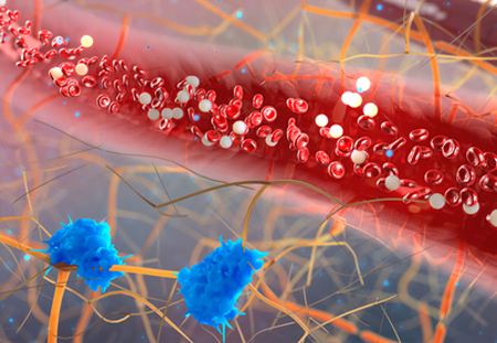 Complex Genetic Disorders Require Multidisciplinary Approaches