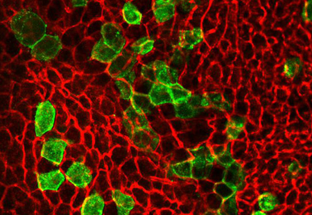 Thermogenesis