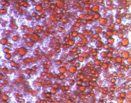 Energy-storing human white adipocytes before treatment ​