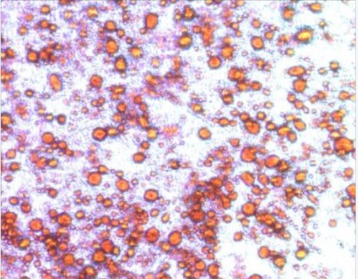Transformation towards fat burning human beige adipocyte